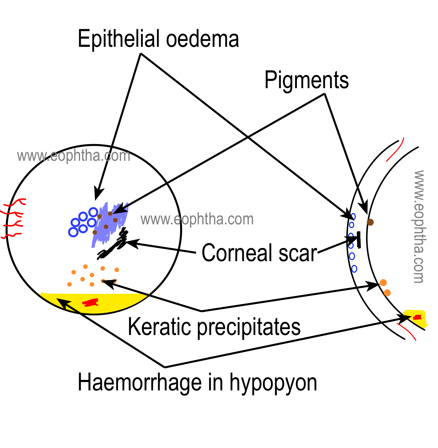 Documentation & Drawing in Ophthalmology